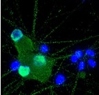Ncardia featured image