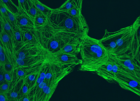 Ncardia featured image