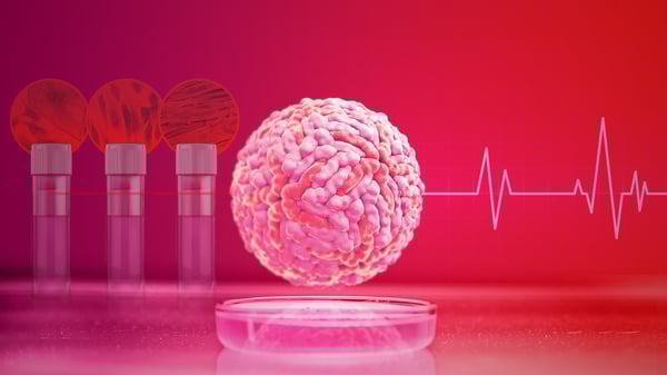 Ncardia_Heart-in-a-box_LI Article Image copy