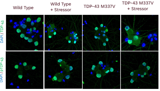 iPSC derived motor neurons displaying ALS phenotype