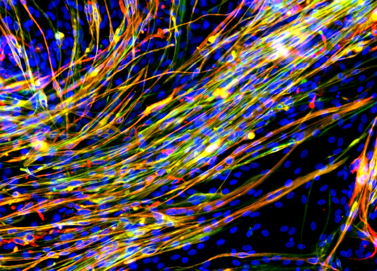 Featured image_Case study 2 skeletal muscle cells