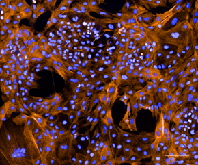 Established cell models - Vascular-Smooth-Muscle-Cells-Calponin