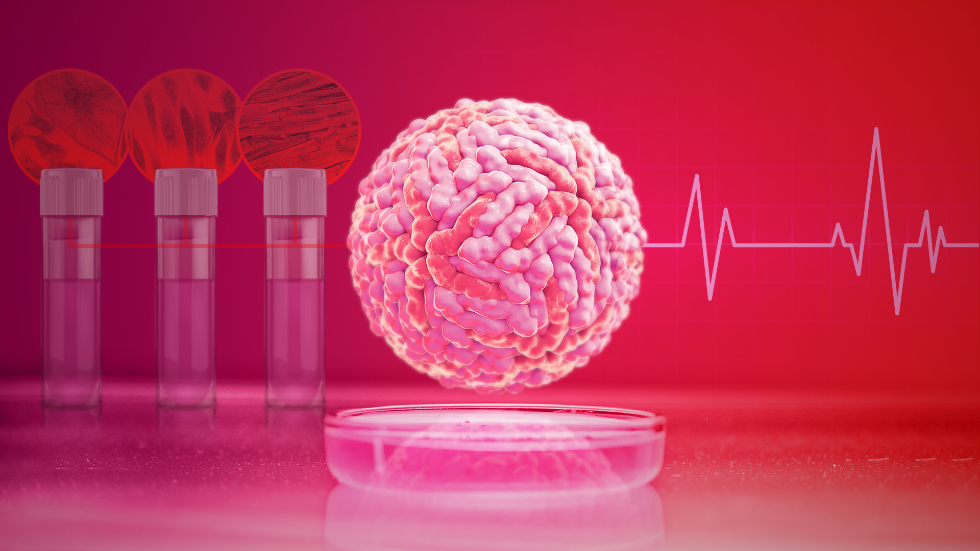 ncardia_heart-in-a-box_graphic